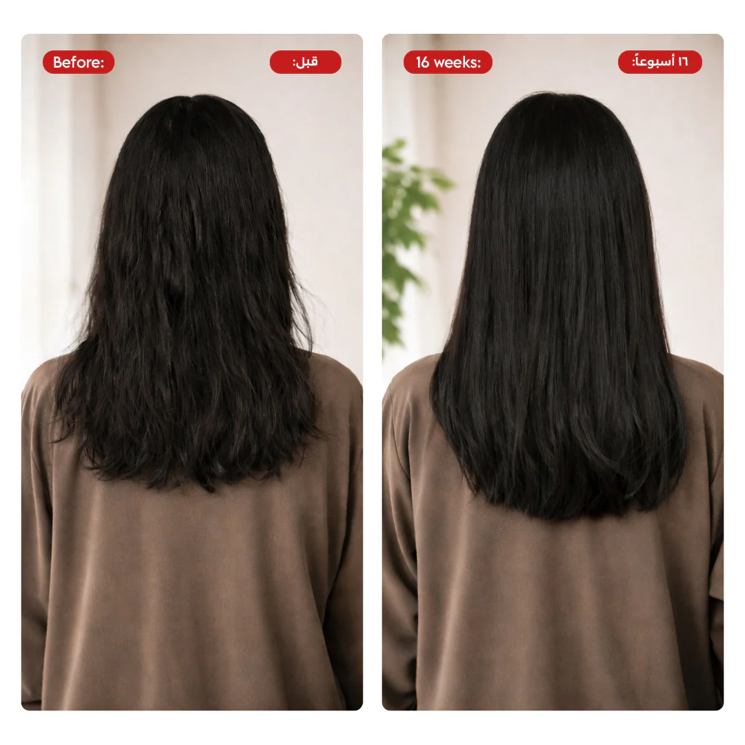 HAIR Gift Set - Image 5